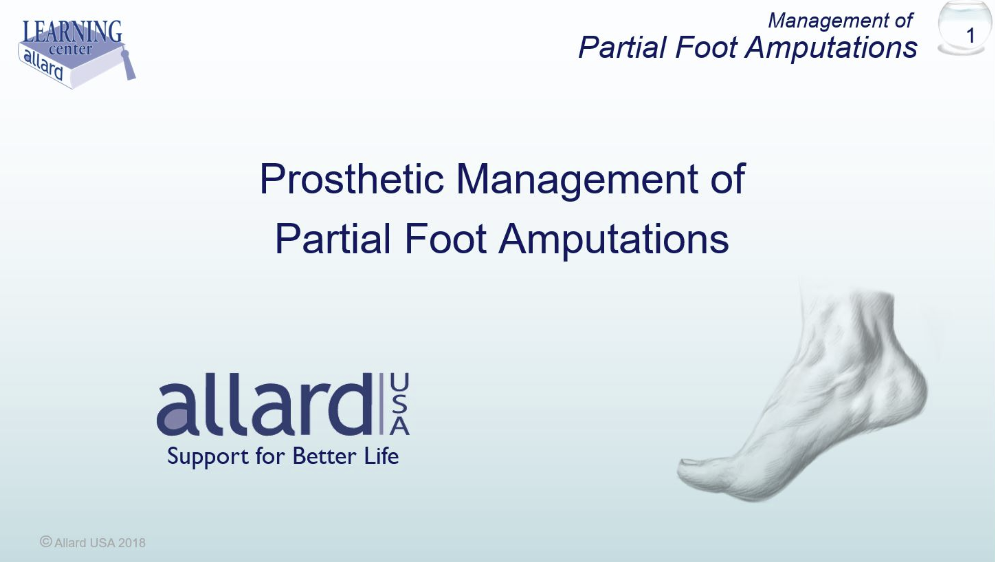 Partial Foot Amputations | Allard USA