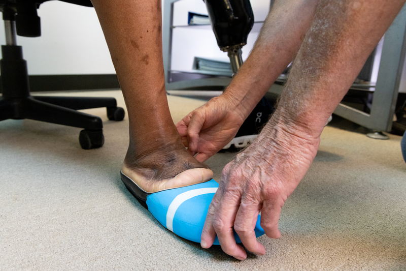 Managing the Partial Foot